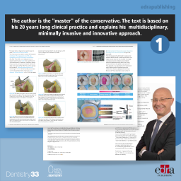 Dental Solutions - Adhesive Restoration - Marco Veneziani - Dental Restoration Techniques - Book Extract