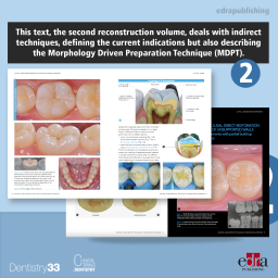 Dental Solutions - Adhesive Restoration - Marco Veneziani - Dental Restoration Techniques - Book Extract