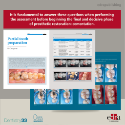 Adhesive cementation on natural teeth - Giacomo Derchi, Umberto Campaner - Dentistry Book - Book Extract