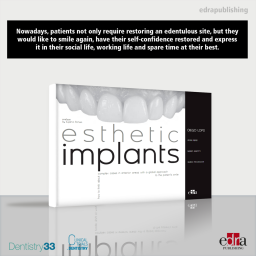 Esthetic Implants. How to think about complex cases in anterior areas - patient smile - dentistry book