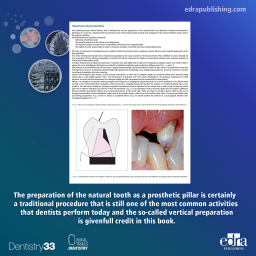 Fixed prosthesis with vertical margin closure - Book Extract - Dentistry Book - Ezio Bruna - Andrea Fabianelli