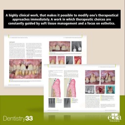 Periodontal Plastic And Regenerative Surgery - cover book - Daniele Cardaropoli -  Dentistry book