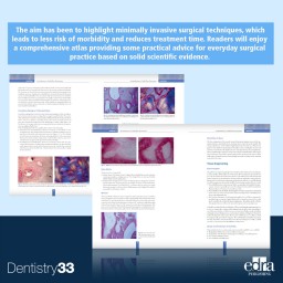 Bone, Biomaterials & Beyond - Book Extract - Dentistry Book - Antonio Barone - Ulf Nannmark