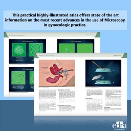 Direct Microscopy in Gynecological Practice - Medicine book - cover book - Giovanni Mi niello