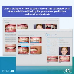 Beyond the Single Tooth - Dentistry Book - Dentistry - Paresh Shah - 9781957260907