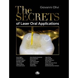 The Secrets of Laser Oral...