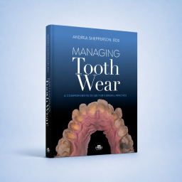 Managing Tooth Wear. A Comprehensive Guide for General Practice - 9781957260334