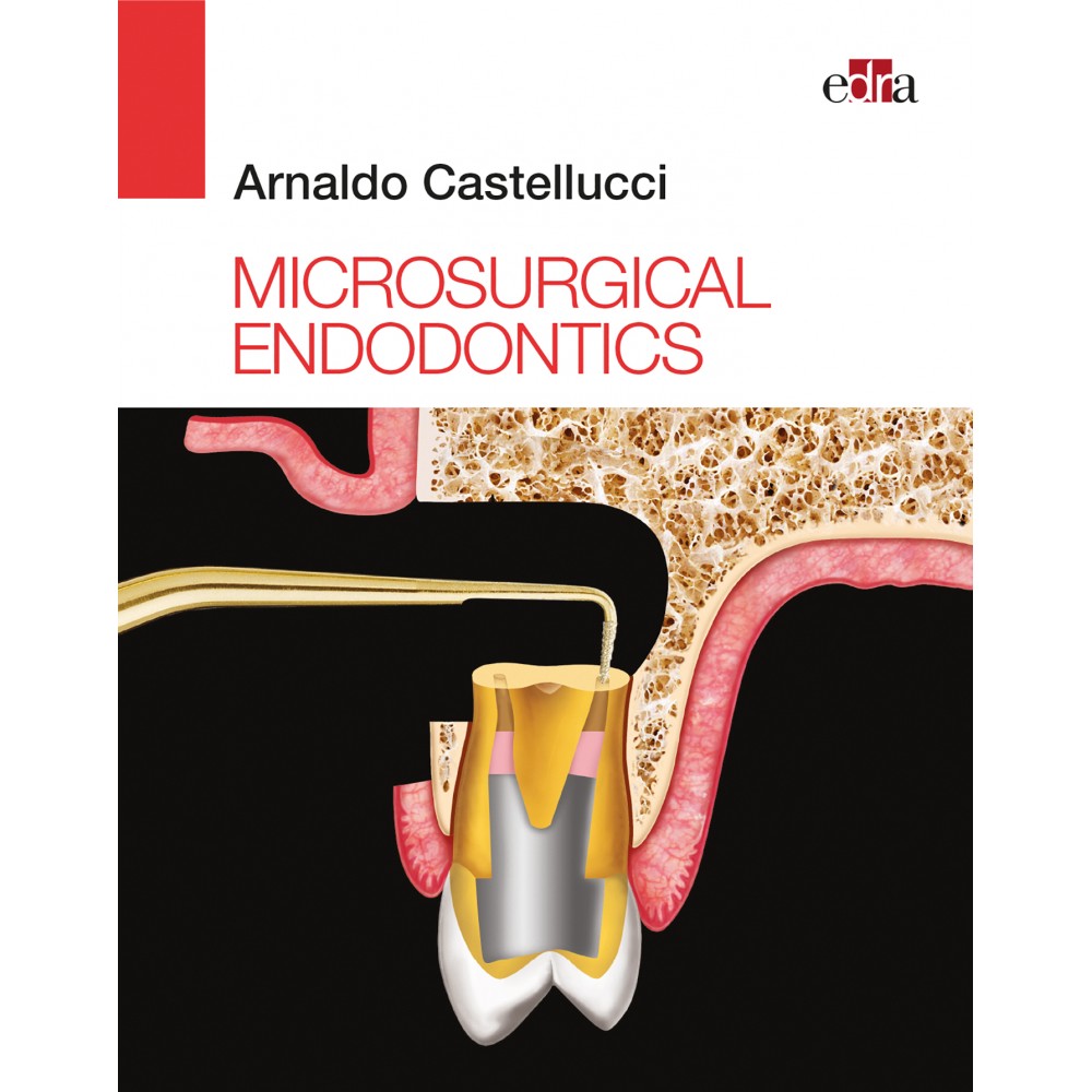 Microsurgical Endodontics - Book Cover - Dentistry book - Endodonitcs Book - Arnaldo Castellucci