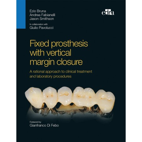 Fixed prosthesis with vertical margin closure - Book Cover - Dentistry Book - Ezio Bruna - Andrea Fabianelli